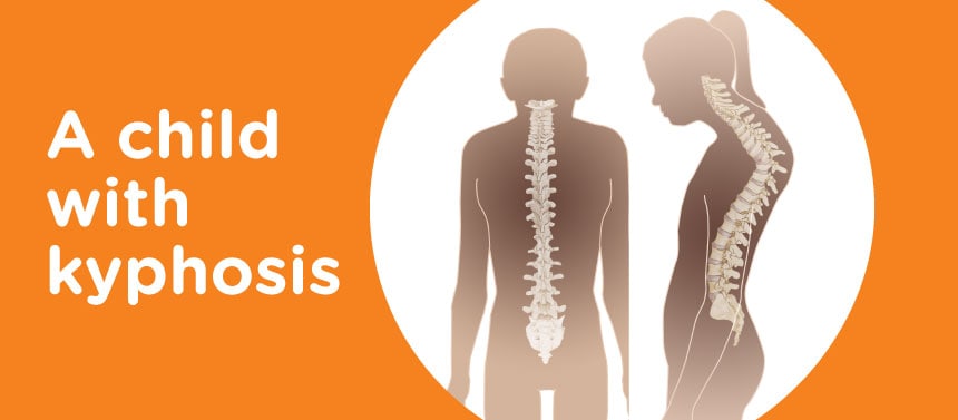 An illustration of a child's silhouette with kyphosis. 