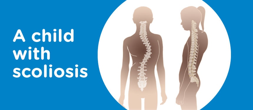 An illustration of a child's silhouette with scoliosis.
