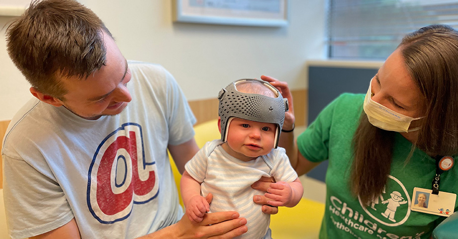 Flat Head Syndrome Baby Cranial Remolding Specialist