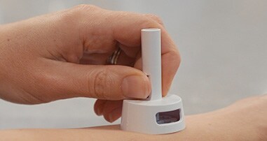 microneedle peanut allergy treatment