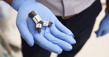 pediatric 3d-printed tracheal splint