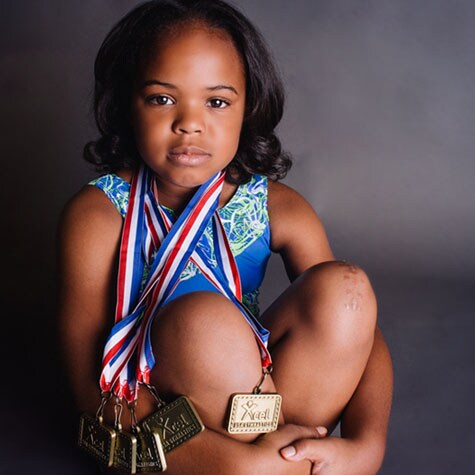 What To Do When Your Child Breaks A Bone Children S Healthcare Of Atlanta What To Do When Your Child Breaks A Bone Children S Healthcare Of Atlanta