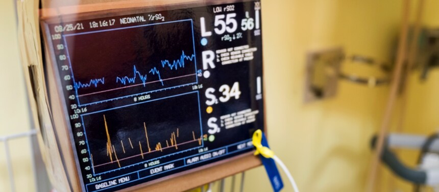 Heart monitor simulation