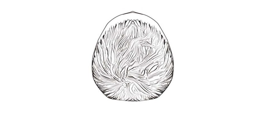 Overhead sketch of the top of a child’s head with one ear appearing more forward than the other